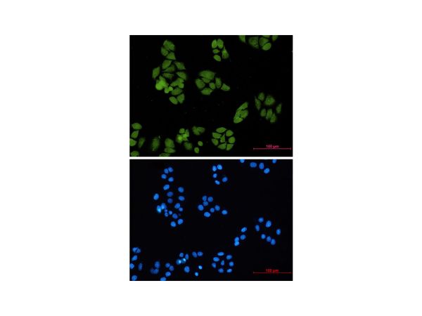 aladdin 阿拉丁 Ab128223 Recombinant Smad4 Antibody Recombinant (R05-1I7); Rabbit anti Human Smad4 Antibody; WB, ICC, IF; Unconjugated