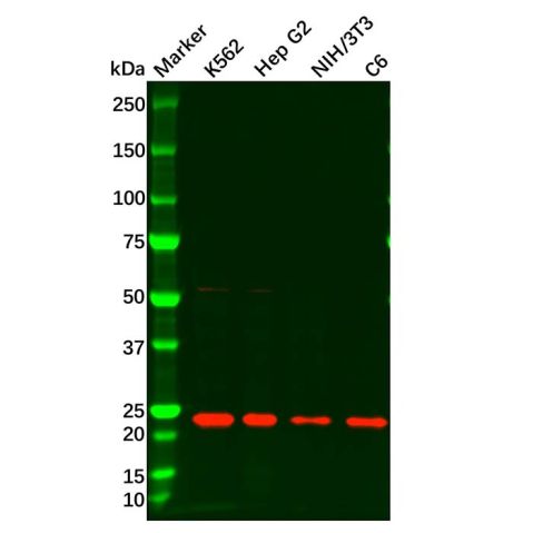 aladdin 阿拉丁 Ab128582 SOCS1 Antibody pAb; Rabbit anti Human SOCS1 Antibody; WB, IHC; Unconjugated