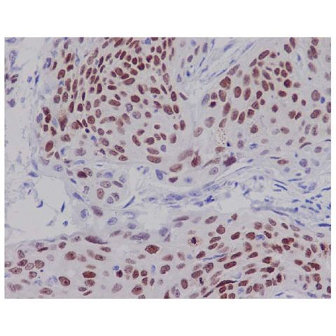 aladdin 阿拉丁 Ab128778 Recombinant SOX2 Antibody Recombinant (R74-1A-2); Rabbit anti Human SOX2 Antibody; WB, IHC, ICC, IF; Unconjugated