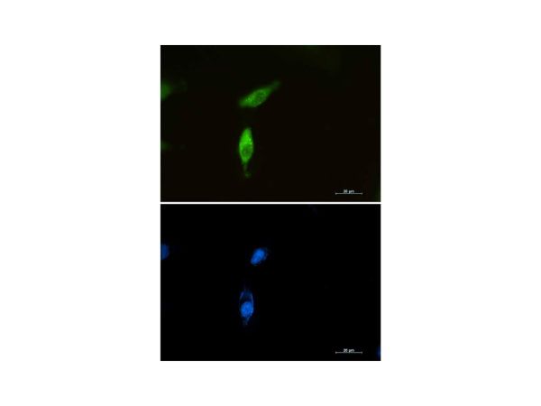 aladdin 阿拉丁 Ab129090 SQSTM1 Mouse mAb mAb (C1); Mouse anti Human SQSTM1 Antibody; WB, IF, ICC; Unconjugated