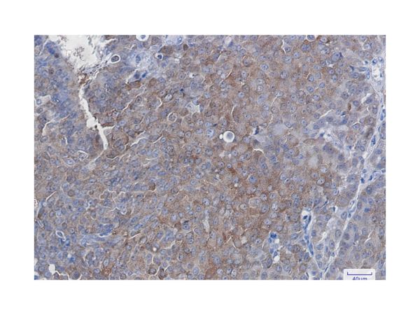 aladdin 阿拉丁 Ab129090 SQSTM1 Mouse mAb mAb (C1); Mouse anti Human SQSTM1 Antibody; WB, IF, ICC; Unconjugated