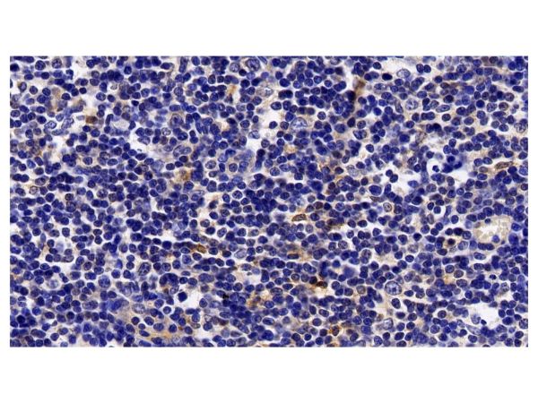 aladdin 阿拉丁 Ab129464 STAT5a Antibody pAb; Rabbit anti Human STAT5a Antibody; WB, IHC; Unconjugated