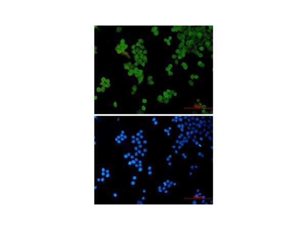 aladdin 阿拉丁 Ab129471 Recombinant STAT5b Antibody Recombinant (R08-2I8); Rabbit anti Human STAT5b Antibody; WB, IHC, ICC, IF; Unconjugated