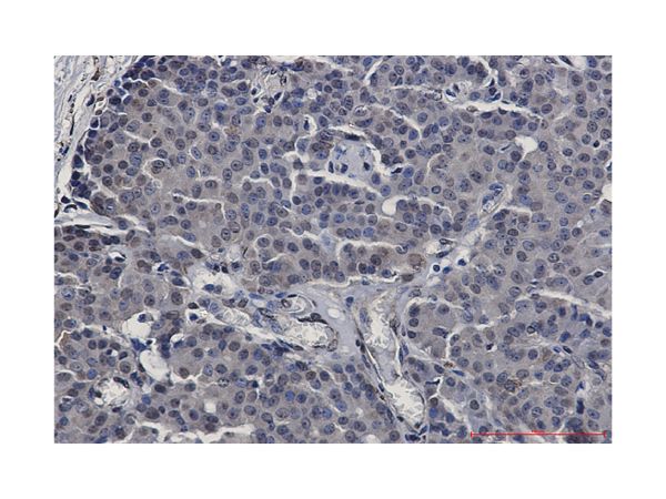 aladdin 阿拉丁 Ab129471 Recombinant STAT5b Antibody Recombinant (R08-2I8); Rabbit anti Human STAT5b Antibody; WB, IHC, ICC, IF; Unconjugated