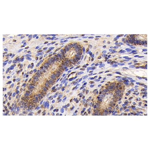 aladdin 阿拉丁 Ab129838 Survivin Mouse mAb mAb (C3); Mouse anti Human Survivin Antibody; WB, IHC; Unconjugated