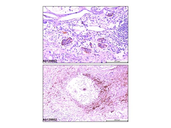 aladdin 阿拉丁 Ab129952 Recombinant Synaptophysin Antibody Recombinant (MyM1-Syn); Mouse anti Human Synaptophysin Antibody; IHC; Unconjugated