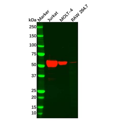 aladdin 阿拉丁 Ab130625 Recombinant TdT Antibody Recombinant (R08-8D9); Rabbit anti Human TdT Antibody; WB; Unconjugated