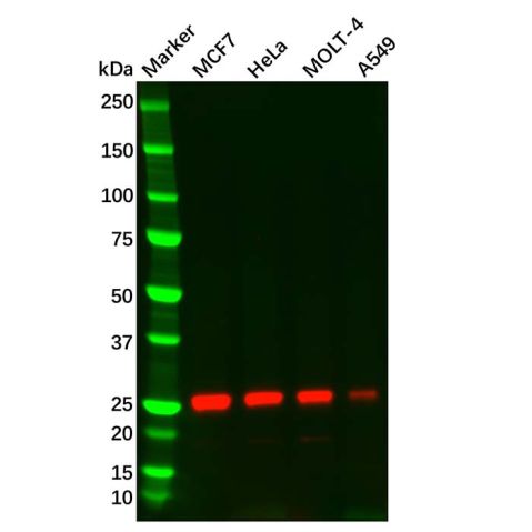 aladdin 阿拉丁 Ab131081 Thymidine Kinase 1/TK1 Mouse mAb mAb (C3); Mouse anti Human Thymidine Kinase 1/TK1 Antibody; WB, ICC, IF; Unconjugated