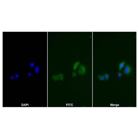 aladdin 阿拉丁 Ab131081 Thymidine Kinase 1/TK1 Mouse mAb mAb (C3); Mouse anti Human Thymidine Kinase 1/TK1 Antibody; WB, ICC, IF; Unconjugated