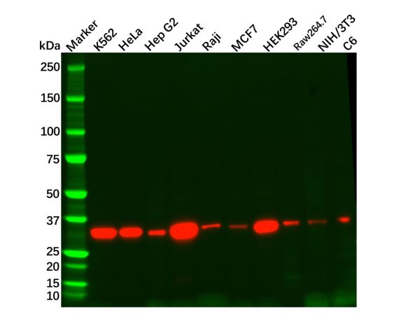 aladdin 阿拉丁 Ab131098 Recombinant Thymidylate Synthase Antibody Recombinant (R08-2F2); Rabbit anti Human Thymidylate Synthase Antibody; WB, IHC, ICC, IF; Unconjugated