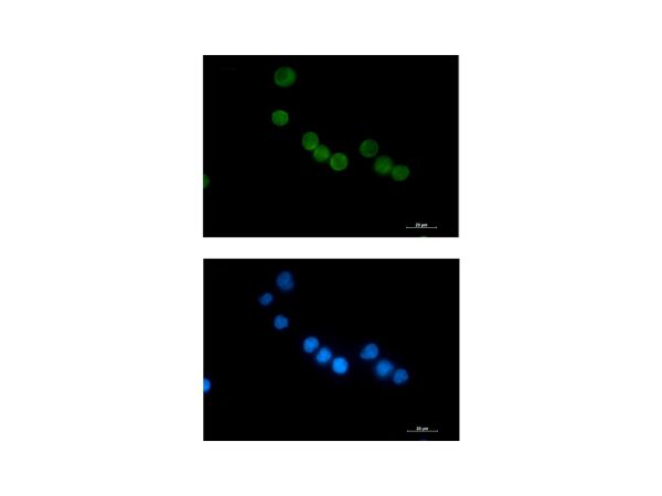 aladdin 阿拉丁 Ab131098 Recombinant Thymidylate Synthase Antibody Recombinant (R08-2F2); Rabbit anti Human Thymidylate Synthase Antibody; WB, IHC, ICC, IF; Unconjugated