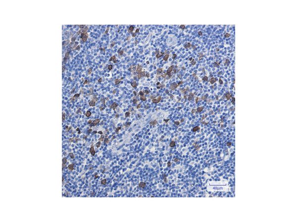aladdin 阿拉丁 Ab131098 Recombinant Thymidylate Synthase Antibody Recombinant (R08-2F2); Rabbit anti Human Thymidylate Synthase Antibody; WB, IHC, ICC, IF; Unconjugated