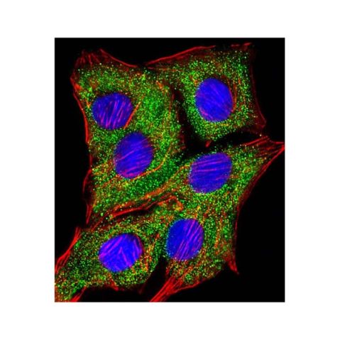 aladdin 阿拉丁 Ab131343 TIMP2 Mouse mAb mAb (1554CT494.262.47); Mouse anti Human TIMP2 Antibody; WB, IHC, ICC, IF, Flow; Unconjugated