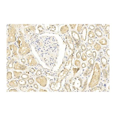 aladdin 阿拉丁 Ab131343 TIMP2 Mouse mAb mAb (1554CT494.262.47); Mouse anti Human TIMP2 Antibody; WB, IHC, ICC, IF, Flow; Unconjugated