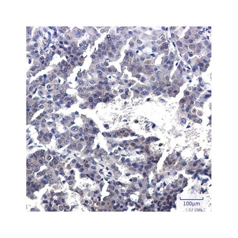 aladdin 阿拉丁 Ab132016 Recombinant TORC2 Antibody Recombinant (R08-5F2); Rabbit anti Human TORC2 Antibody; WB, IHC Unconjugated