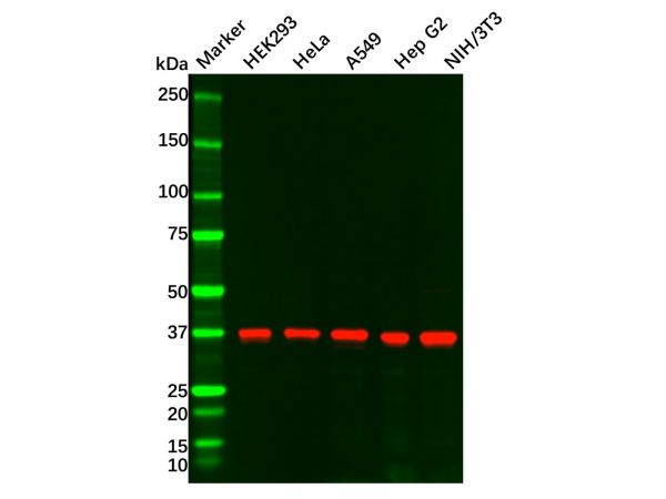 aladdin 阿拉丁 Ab132947 Recombinant TTF1 Antibody Recombinant (R07-3I9); Rabbit anti Human TTF1 Antibody; WB, IHC, ICC, IF; Unconjugated