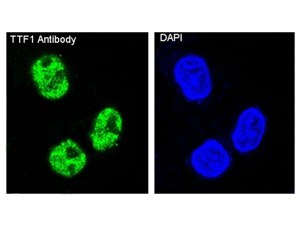 aladdin 阿拉丁 Ab132947 Recombinant TTF1 Antibody Recombinant (R07-3I9); Rabbit anti Human TTF1 Antibody; WB, IHC, ICC, IF; Unconjugated