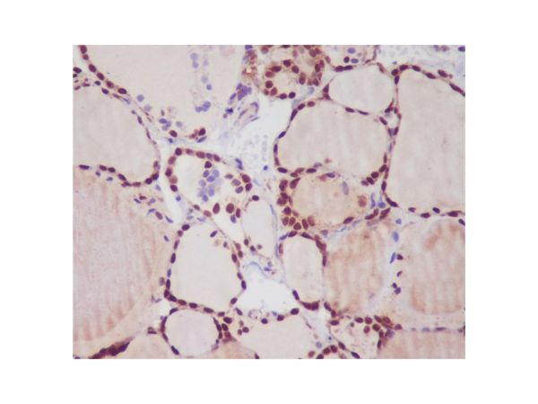aladdin 阿拉丁 Ab132947 Recombinant TTF1 Antibody Recombinant (R07-3I9); Rabbit anti Human TTF1 Antibody; WB, IHC, ICC, IF; Unconjugated