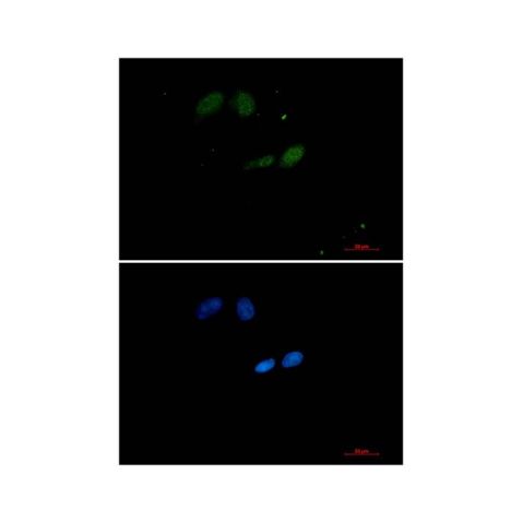 aladdin 阿拉丁 Ab133246 Recombinant UBE2I Antibody Recombinant (R01-6I6); Rabbit anti Human UBC9 Antibody; WB, IHC, ICC, IF; Unconjugated