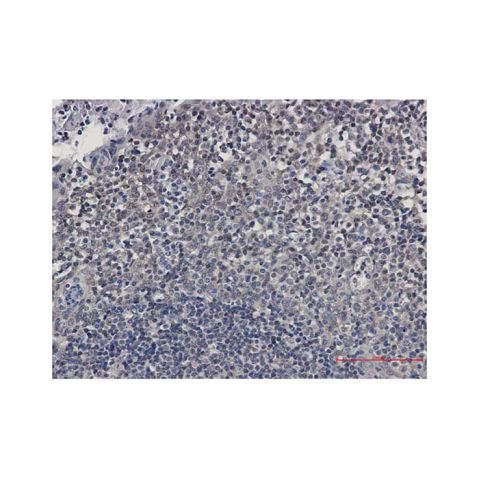 aladdin 阿拉丁 Ab133246 Recombinant UBE2I Antibody Recombinant (R01-6I6); Rabbit anti Human UBC9 Antibody; WB, IHC, ICC, IF; Unconjugated