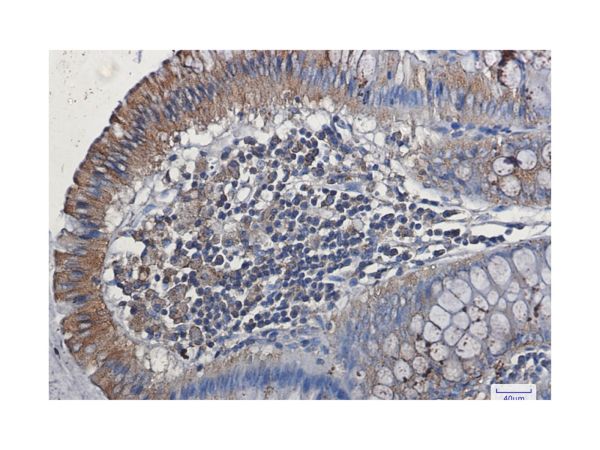 aladdin 阿拉丁 Ab134030 Recombinant VEGF Receptor 1 Antibody Recombinant (R06-1A4); Rabbit anti Human VEGF Receptor 1 Antibody; WB, IHC; Unconjugated