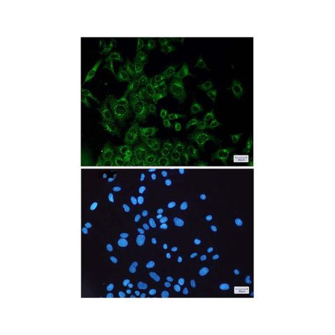 aladdin 阿拉丁 Ab134116 Recombinant VEGFD Antibody Recombinant (R03-8H6); Rabbit anti Human VEGFD Antibody; WB, IHC, ICC, IF; Unconjugated