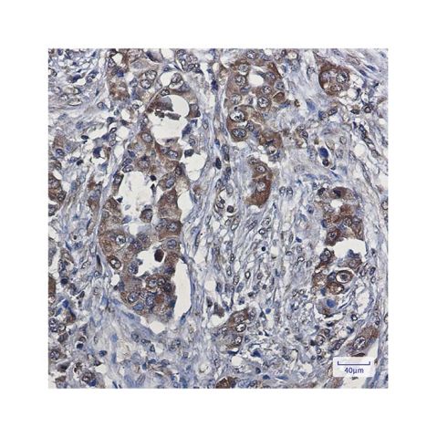 aladdin 阿拉丁 Ab134116 Recombinant VEGFD Antibody Recombinant (R03-8H6); Rabbit anti Human VEGFD Antibody; WB, IHC, ICC, IF; Unconjugated