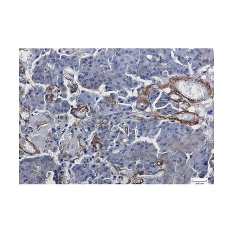 aladdin 阿拉丁 Ab134234 Recombinant Vinculin Antibody Recombinant (R09-1F3); Rabbit anti Human Vinculin Antibody; WB, IHC; Unconjugated