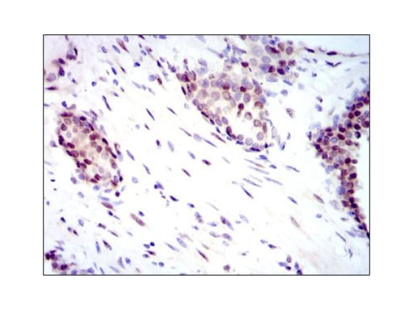 aladdin 阿拉丁 Ab134985 YAP1 Mouse mAb mAb(1A12); Mouse anti Human YAP1 Antibody; ELISA, WB, IHC, Flow; Unconjugated