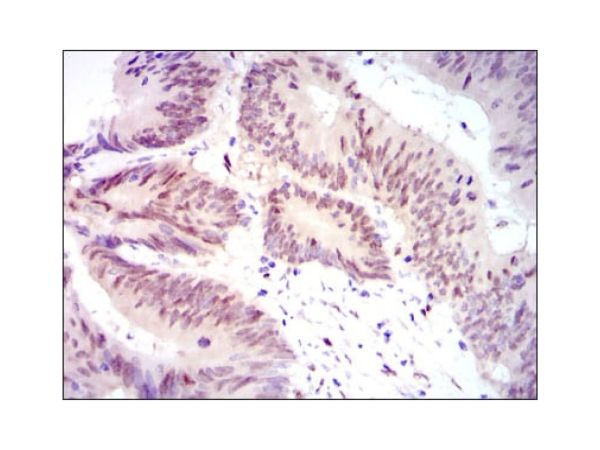aladdin 阿拉丁 Ab134985 YAP1 Mouse mAb mAb(1A12); Mouse anti Human YAP1 Antibody; ELISA, WB, IHC, Flow; Unconjugated