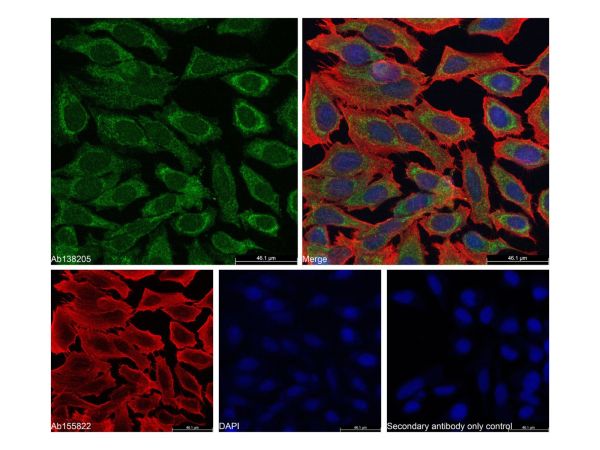 aladdin 阿拉丁 Ab138205 Goat Anti-Rabbit IgG H&L (Alexa Fluor? 488) pAb; Goat Anti-Rabbit IgG H&L (Alexa Fluor? 488); ICC, IF, IHC, Flow, ELISA