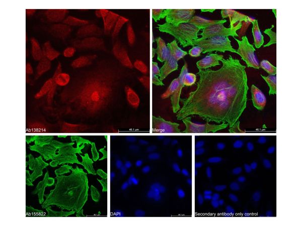 aladdin 阿拉丁 Ab138214 Goat Anti-Rabbit IgG H&L (Alexa Fluor? 594) pAb; Goat Anti-Rabbit IgG H&L (Alexa Fluor? 594); ICC, IF, IHC, Flow, ELISA