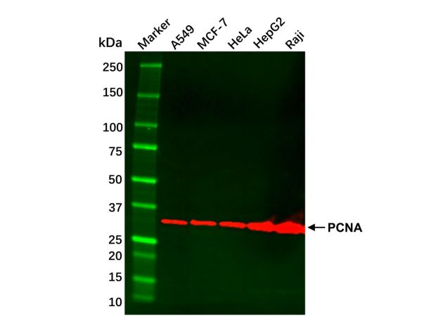 aladdin 阿拉丁 cl155894 HeLa Whole Cell Lysate 200μg, Mycoplasma free