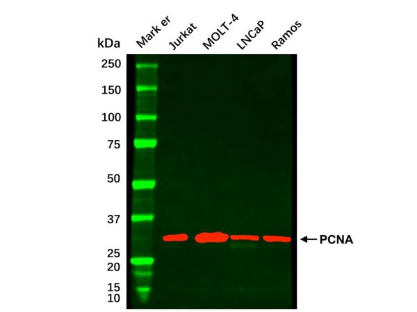 aladdin 阿拉丁 cl155897 Jurkat Whole Cell Lysate 200μg, Mycoplasma free