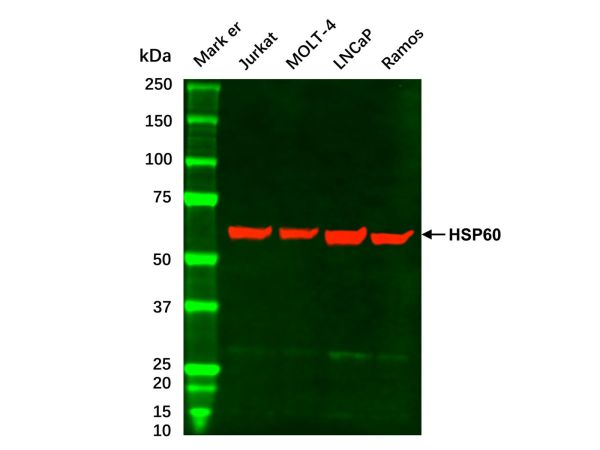 aladdin 阿拉丁 cl155902 LNCaP Whole Cell Lysate Mycoplasma free