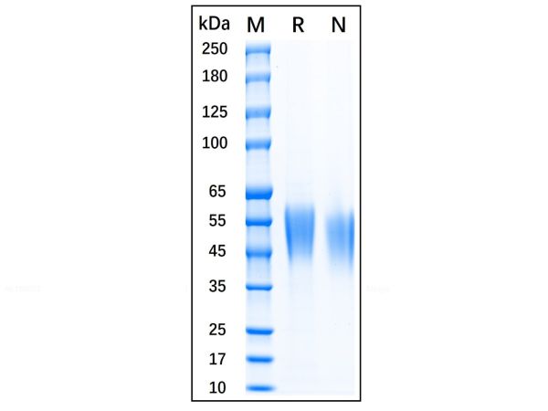 aladdin 阿拉丁 rp144122 Recombinant Human CD80 Protein Animal Free, >95% (SDS-PAGE), Active, 293F cell, His-tag, 35-242 aa