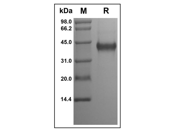 aladdin 阿拉丁 rp144926 Recombinant Human CYR61/CCN1 Protein Animal Free, >95%(SDS-PAGE, HPLC), Active, E.coli, No tag, 25-381 aa