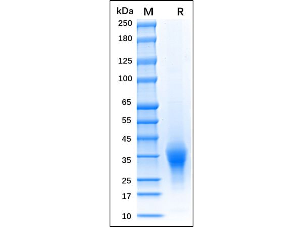 aladdin 阿拉丁 rp145590 Recombinant Human EpCAM Protein Animal Free , >95%(SDS-PAGE), Active, 293F, His tag, 24-265 aa