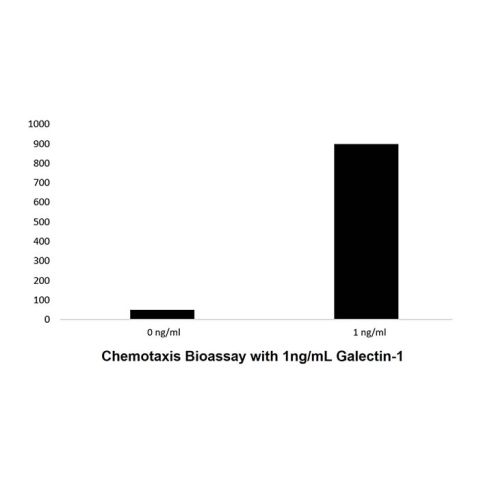 aladdin 阿拉丁 rp146257 Recombinant Human Galectin-1 Protein Animal Free, >95% (SDS-PAGE&HPLC), Active, E. coli, No tag, 2-135 aa