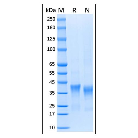 aladdin 阿拉丁 rp147566 Recombinant Human IL-34 Protein Animal Free, ≥95% (SDS-PAGE), Active, CHO, C-His tag, 21-242 aa