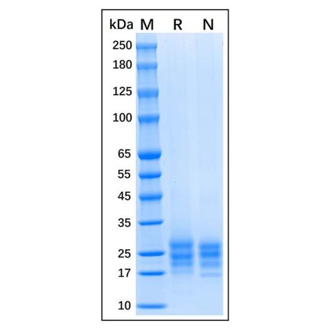 aladdin 阿拉丁 rp147650 Recombinant Human IL-9 Protein Animal Free, ≥97% (SDS-PAGE), Active, Baculovirus Insect Cells, C-His tag, 19-144 aa