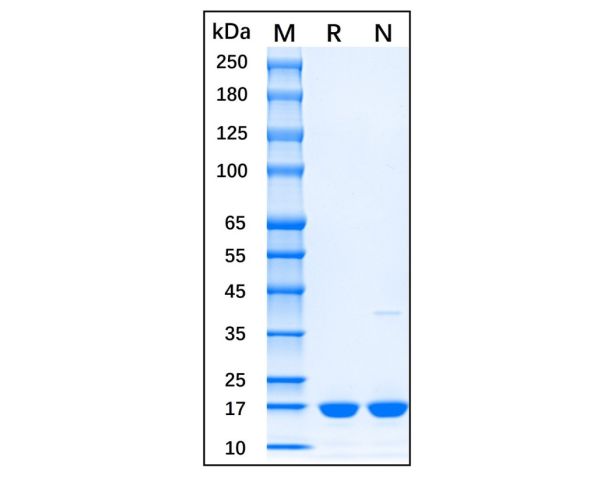 aladdin 阿拉丁 rp154118 Recombinant Mouse IL-1 beta Protein Animal Free, >95%(SDS-PAGE), Active, E.coli, His tag, 118-269 aa