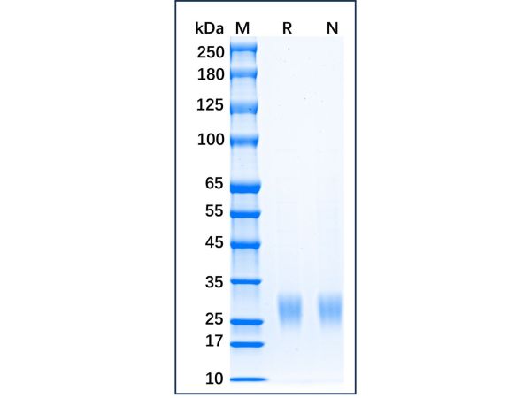 aladdin 阿拉丁 rp154174 Recombinant Mouse IL-2 Protein Animal Free, >98%(SDS-PAGE), Active, 293F cell, His, 21-169aa