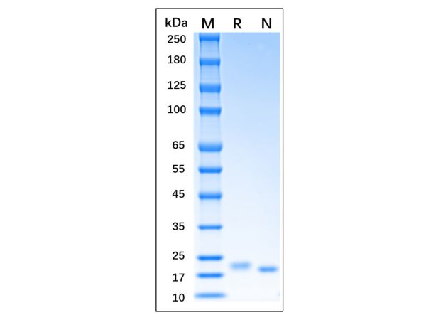aladdin 阿拉丁 rp154236 Recombinant Mouse IL-6 Protein Animal free, ＞96%(SDS-PAGE,HPLC), Active, E.coli, No tag, 25-211 aa 