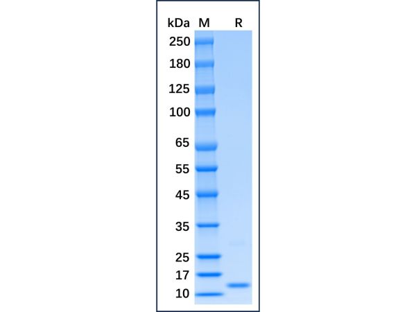 aladdin 阿拉丁 rp154258 Recombinant Mouse IFN-gamma Protein Animal Free, >98%(SDS-PAGE), Active, E.coli, His, 23-155aa