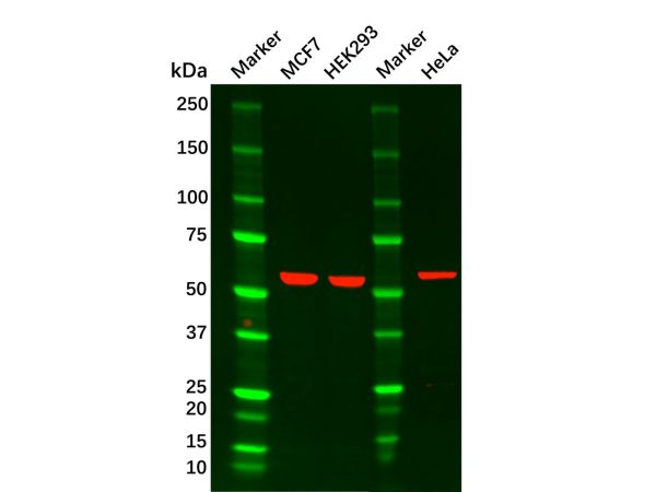 aladdin 阿拉丁 Ab087937 AKT1 Mouse mAb mAb (1F7E10); Mouse anti Human AKT1 Antibody; WB, ICC, IF, Flow, ELISA; Unconjugated