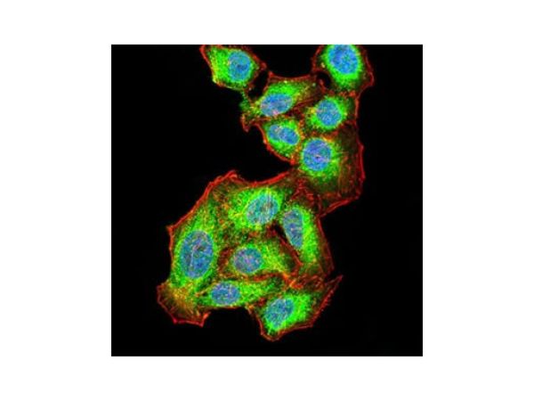aladdin 阿拉丁 Ab087937 AKT1 Mouse mAb mAb (1F7E10); Mouse anti Human AKT1 Antibody; WB, ICC, IF, Flow, ELISA; Unconjugated