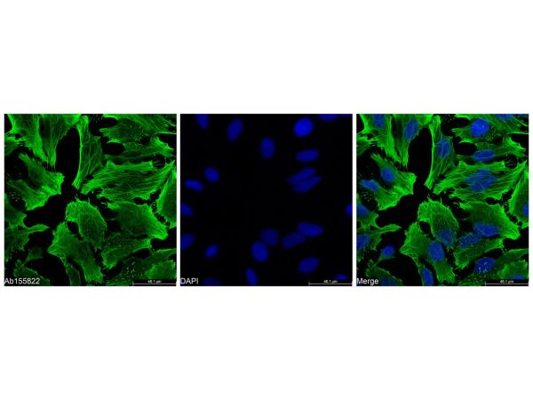 aladdin 阿拉丁 Ab155822 beta Actin Mouse mAb mAb (2D10); Mouse anti Human beta actin Antibody; WB, Flow, ICC/IF, ELISA; Unconjugated