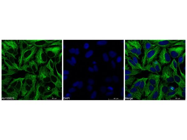 aladdin 阿拉丁 Ab155823 beta Tubulin Mouse mAb mAb (2F1); Mouse anti Human beta tubulin Antibody; WB, Flow, ICC / IF, ELISA; Unconjugated