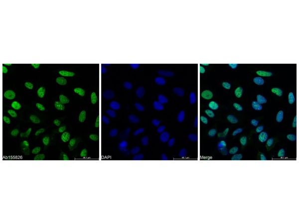 aladdin 阿拉丁 Ab155826 PCNA Mouse mAb mAb (3D7); Mouse anti Human PCNA Antibody; WB, Flow, ICC/IF, ELISA; Unconjugated